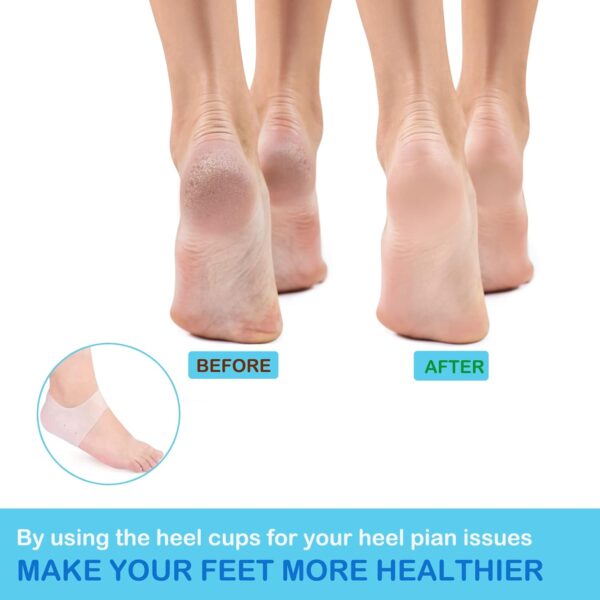 heel protectors